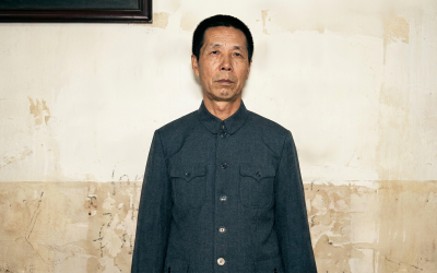 Intestine Cancer Survivor Story: The Cancer Cells Disappeared
